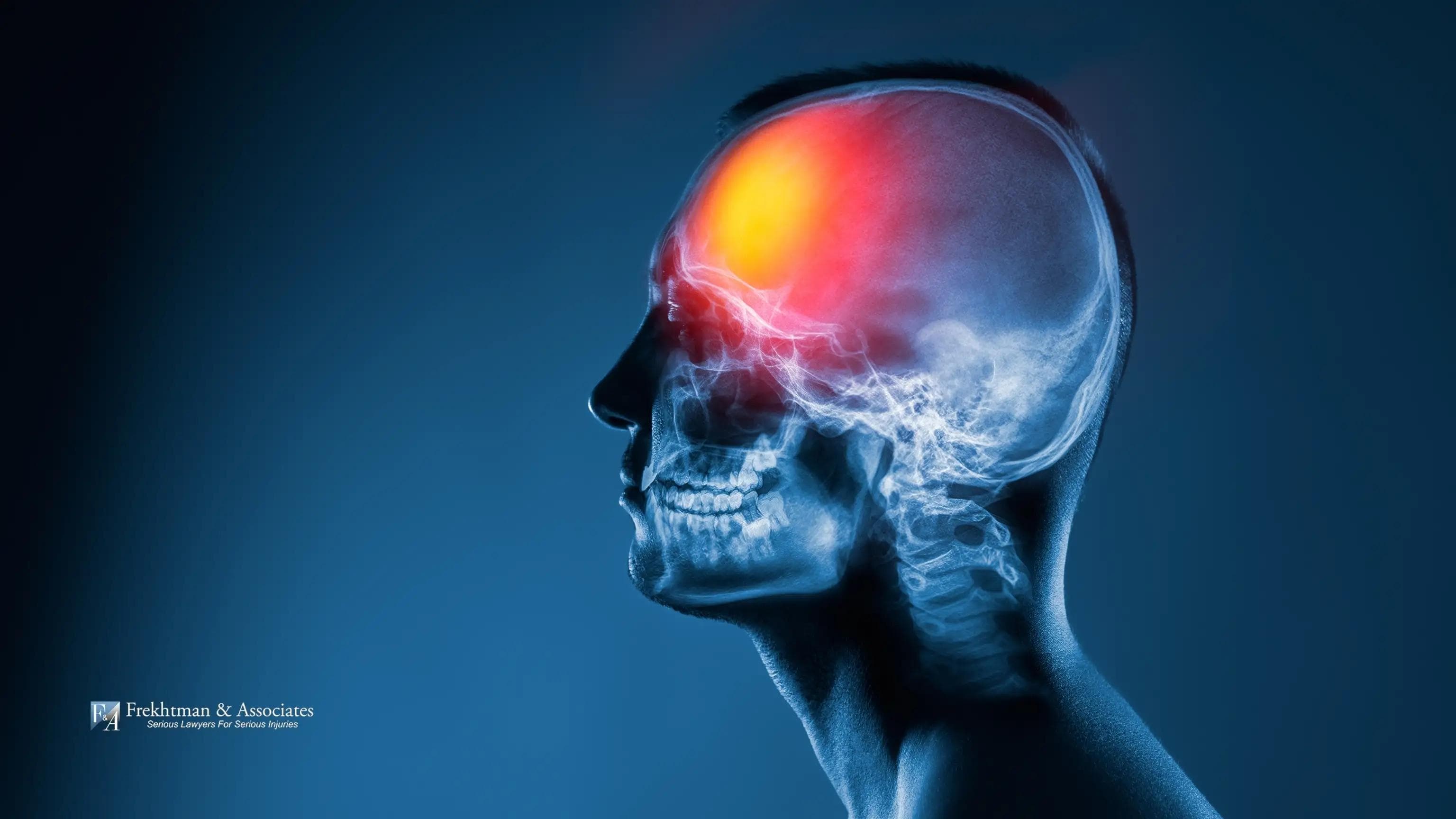 Scan showing the impact of the injury